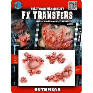 Tinsley FX Transfers, Outbreak