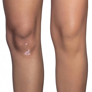 Dermablend Quick-Fix Body