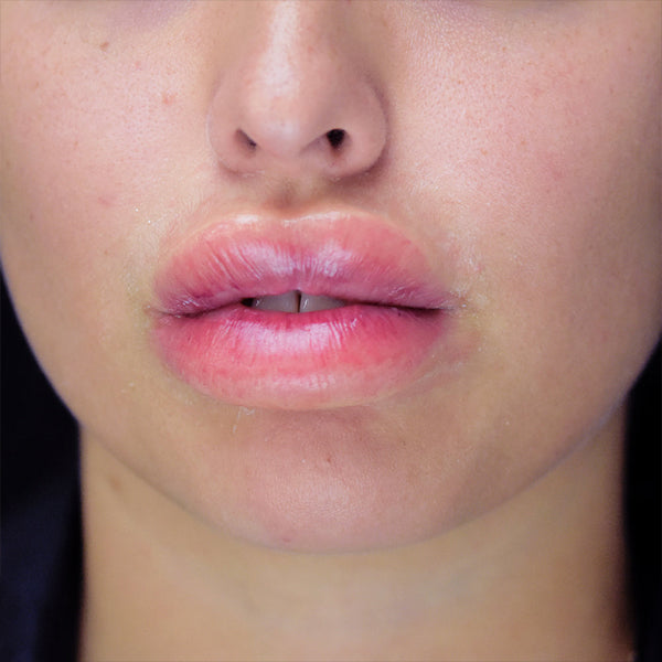 Out Of Kit Peel N&#39; Stick Prosthetics, Swollen Lips
