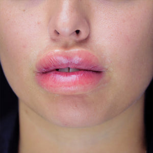 Out Of Kit Peel N' Stick Prosthetics, Swollen Lips