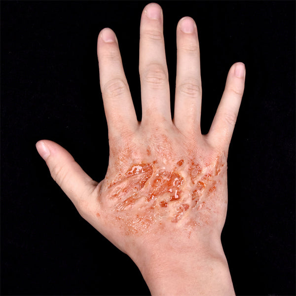 Out Of Kit Peel N&#39; Stick Prosthetics, Burn (Large)