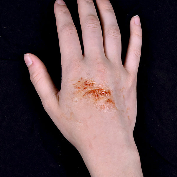 Out Of Kit Peel N&#39; Stick Prosthetics, Burn (XS)