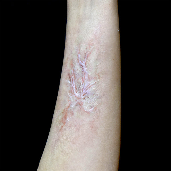 Out Of Kit Peel N&#39; Stick Prosthetics, Healed Burn Scar 3