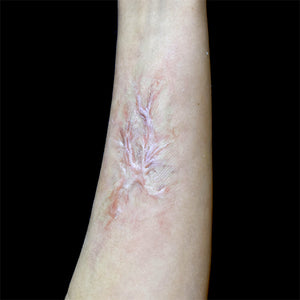 Out Of Kit Peel N' Stick Prosthetics, Healed Burn Scar 3