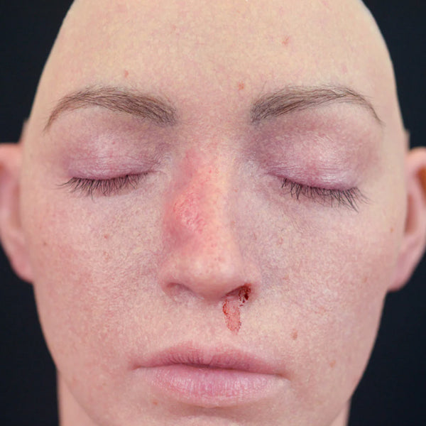 Out Of Kit Peel N&#39; Stick Prosthetics, Broken Nose