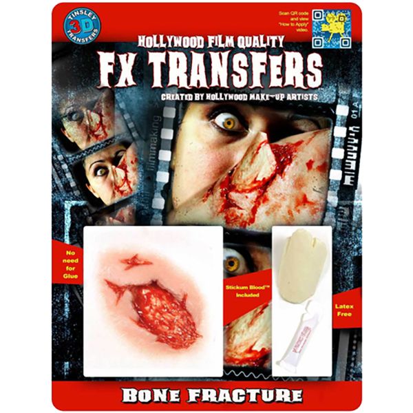 Tinsley FX Transfers,  Bone Fracture