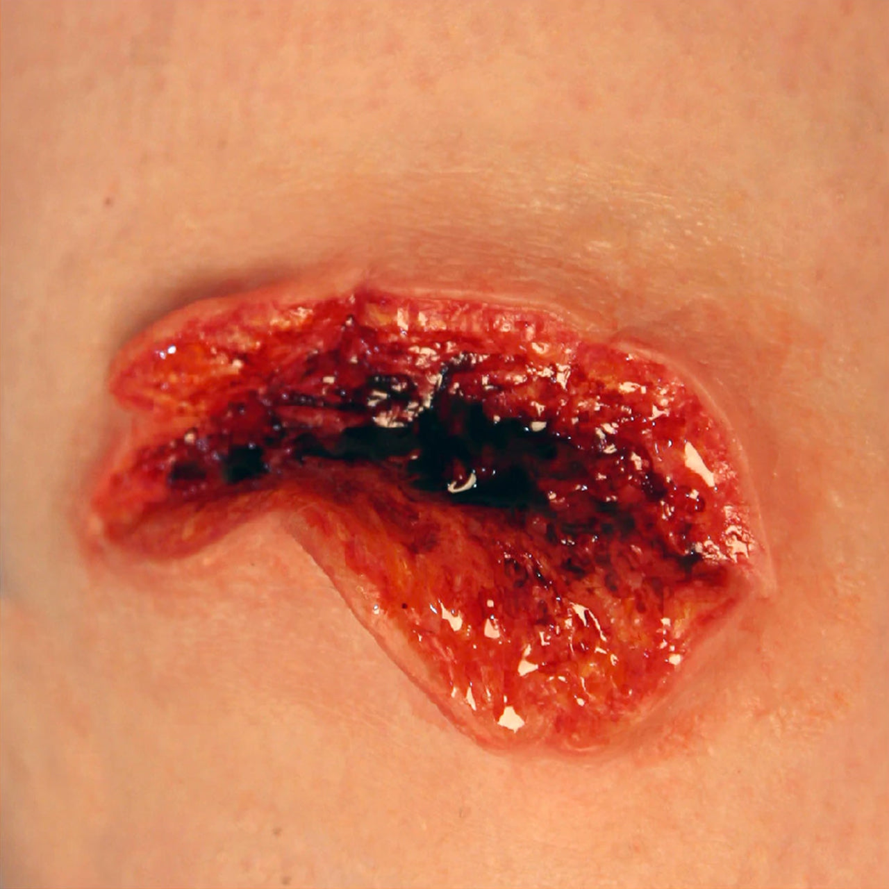 Prosthetic Transfer Material Avulsion Molds Large