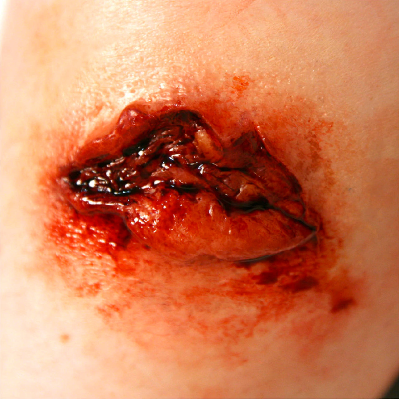 Prosthetic Transfer Material Avulsion Molds Medium