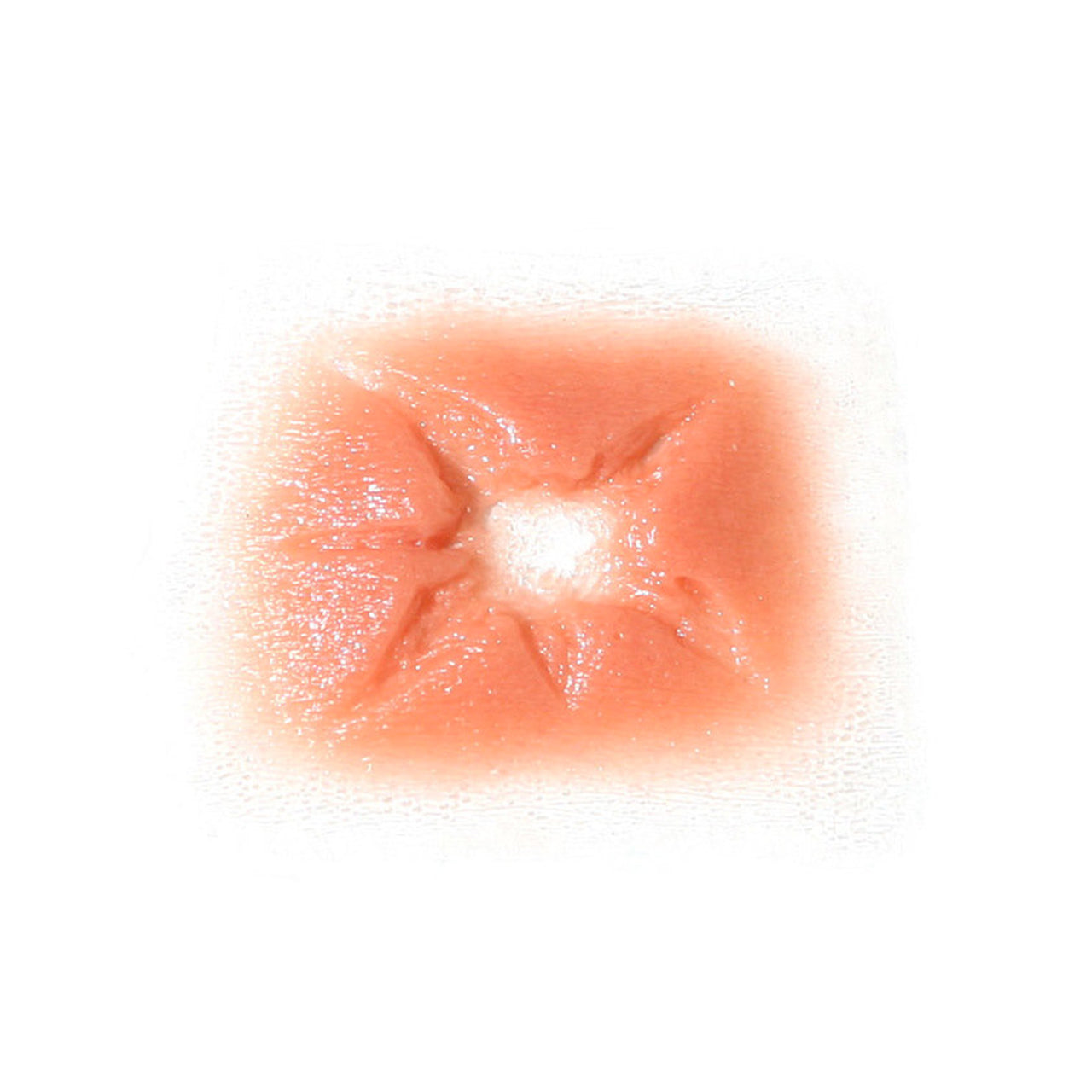 Prosthetic Transfer Material Bullet Hole Molds Exit 6 Point Starfish