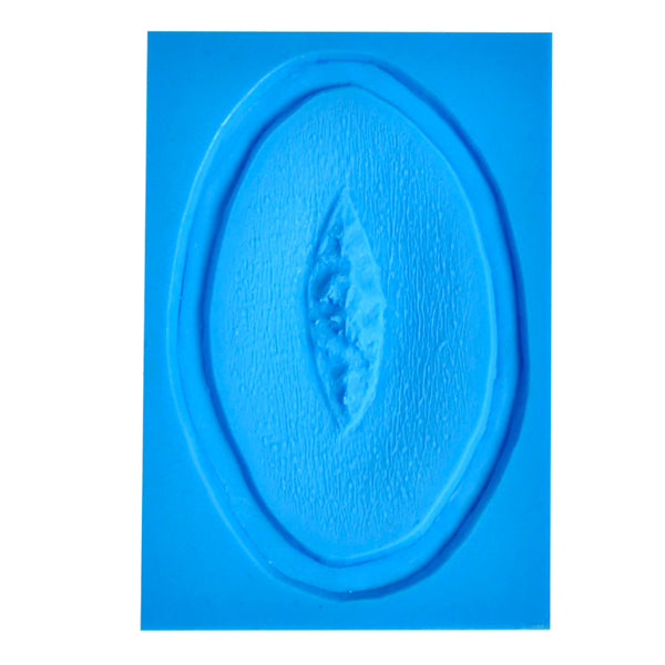 Prosthetic Transfer Material Laceration Molds 3&#39;&#39;